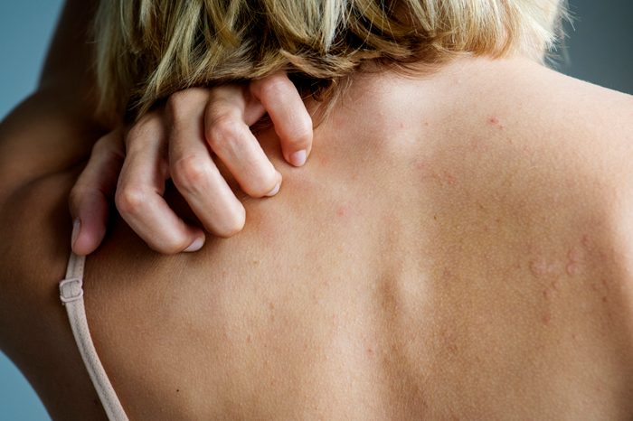 rear view shot of a woman scratching her back