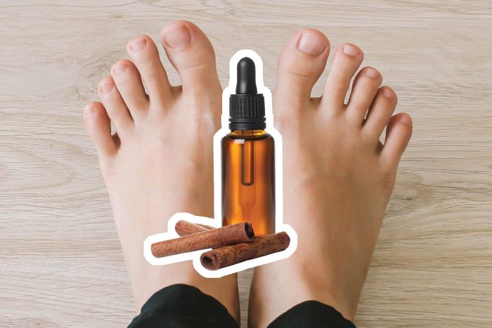 Cinnamon oil over feet