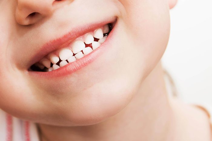 closeup of a young child's smiling mouth