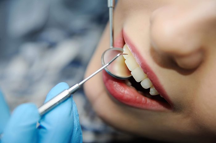 dentist checking patient's teeth with mirror and scraper