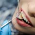 35 Secrets Your Dentist Won't Tell You