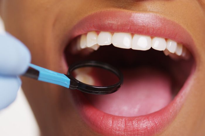 Dentist putting a mirror under a woman's mouth and teeth.