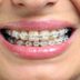 11 Things Your Orthodontist Won't Tell You