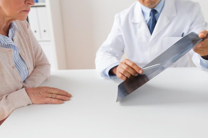 Doctor showing a woman an X-ray.