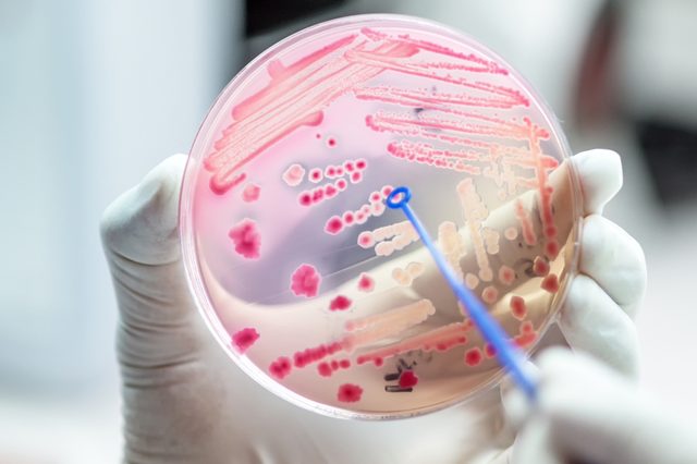 Close up the media plate on hand medical technicians working on bacteria culture and drug resistance of pathogens in laboratory; Escherichia coli colonies media plate bacteria culture growth.