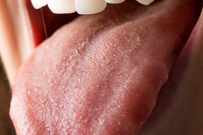 Close up of mouth of girl with her tongue out