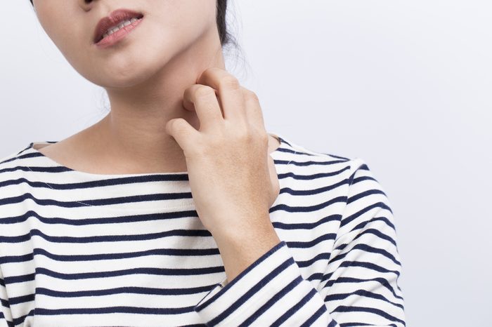 Woman scratching her neck