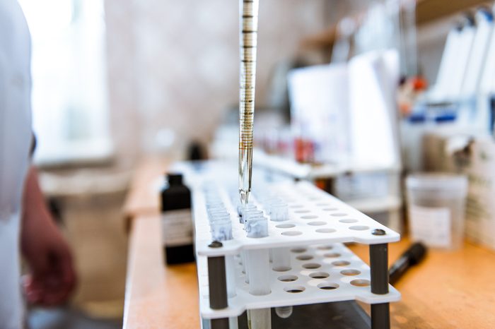 Hand takes test tube assays out of a holder in a lab