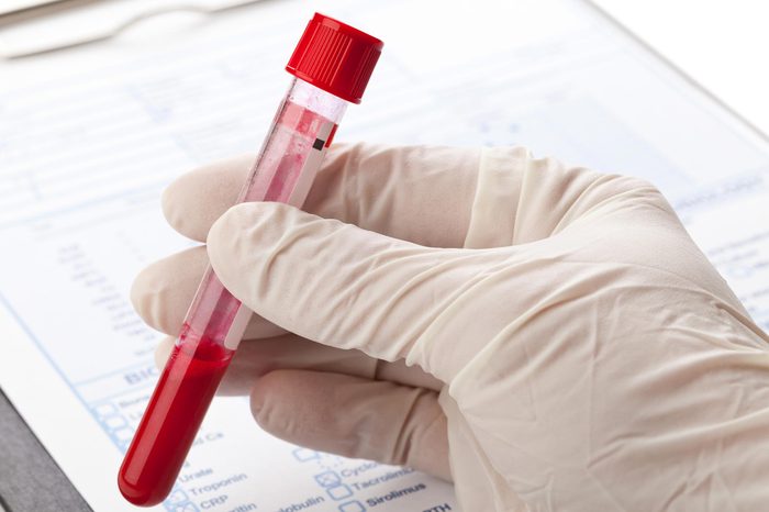 gloved hand holding a vial of blood