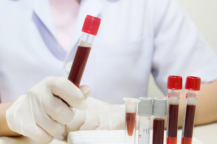 close up of young female holding tube with blood sample making and test or research in clinical laboratory