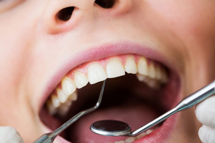 Close-up of female with open mouth during oral checkup at the dentist