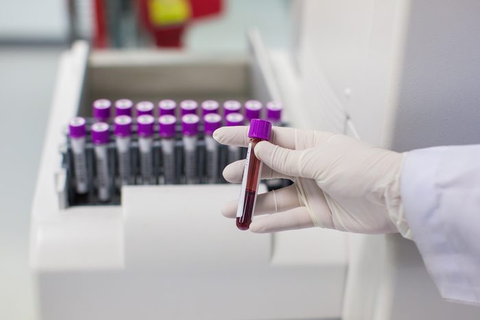 Technician wearing glove holding blood tube in a lab