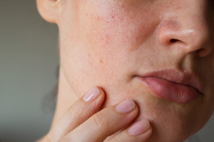 pores on the skin of the face. Cleansing the face skin