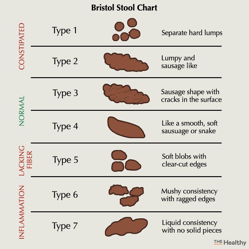 bristol stool chart