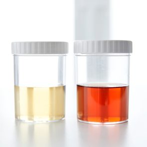 two urine sample cups side by side