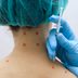 Can Trigger Point Injections Treat Your Pain?