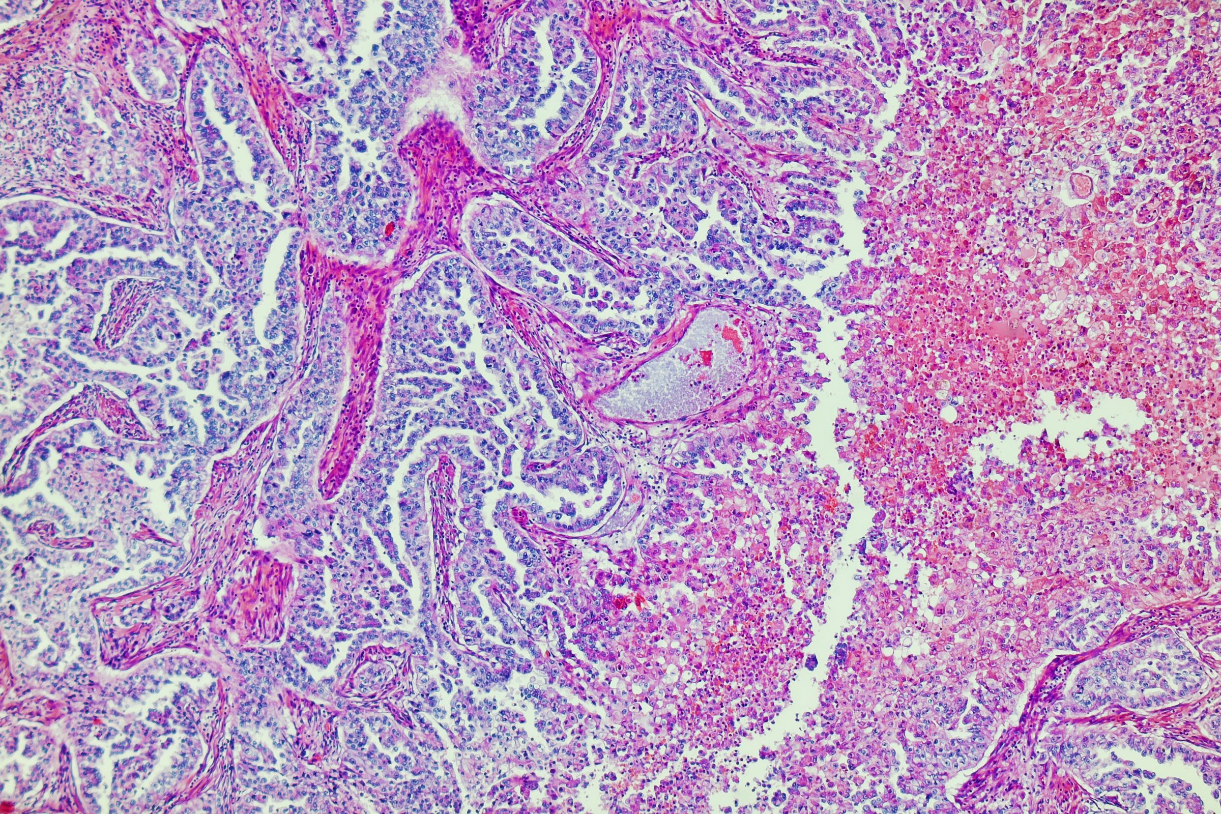 Human liver tissue under microscope view