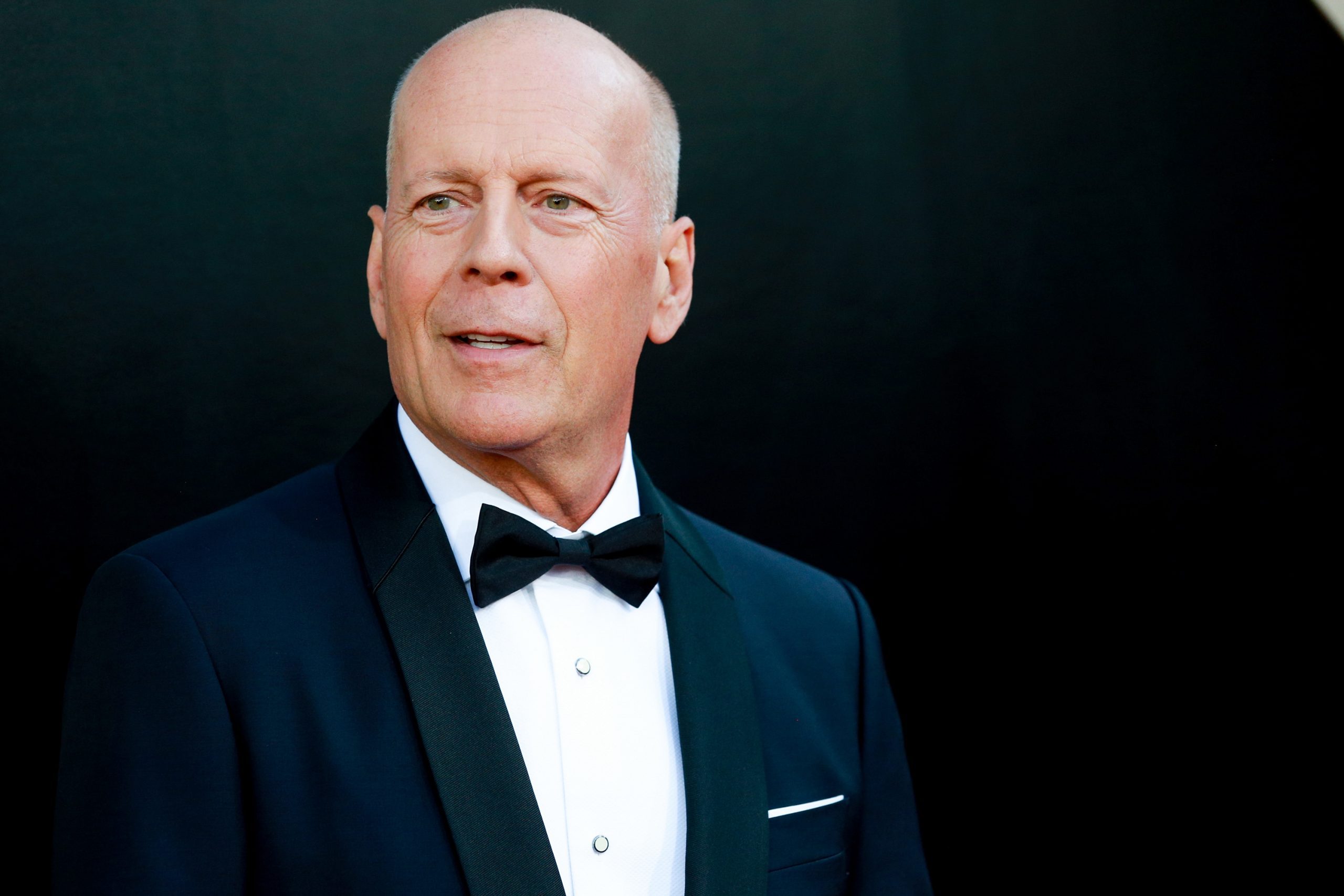 What Is Frontotemporal Dementia? Bruce Willis’ Condition, Explained.