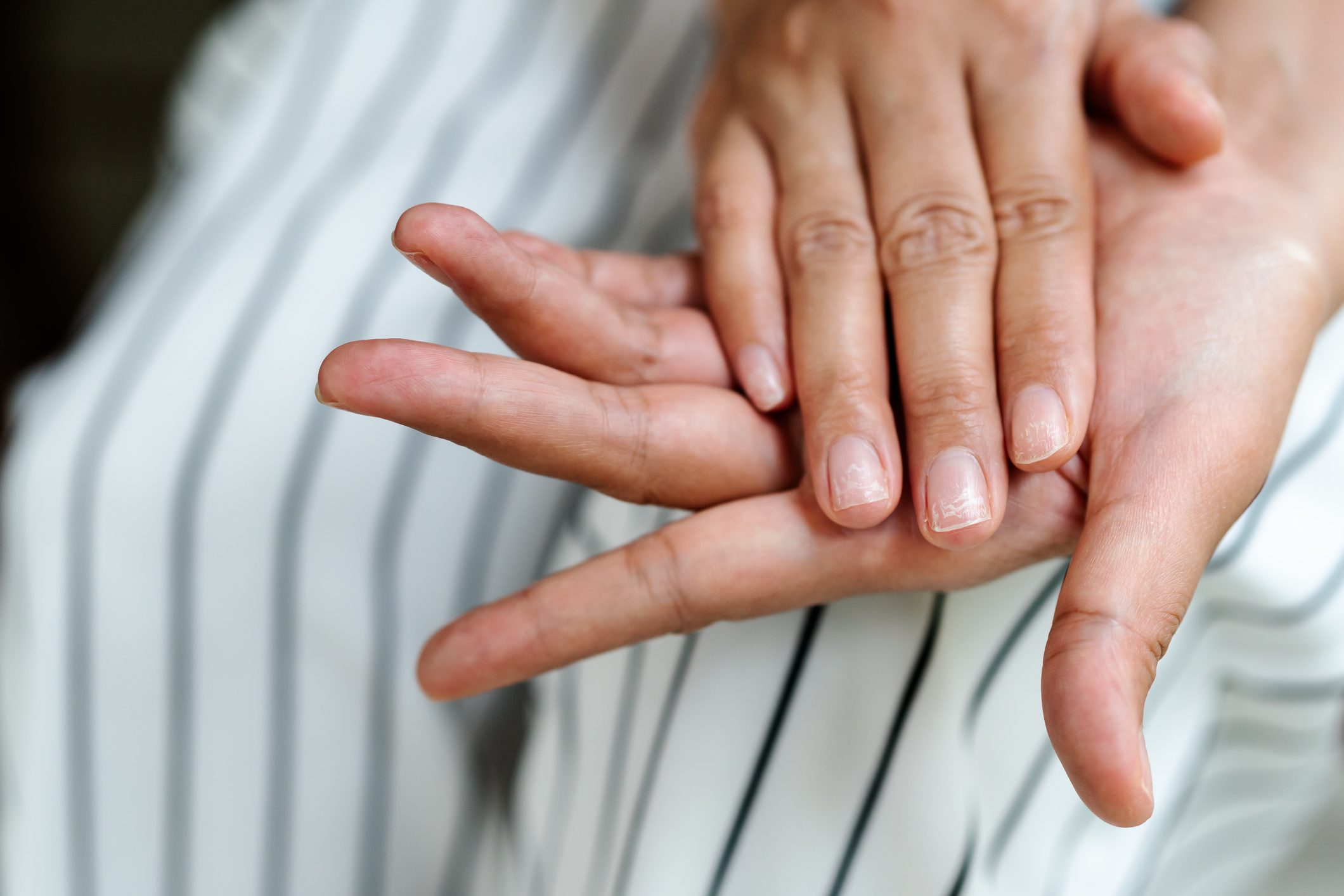 brittle damaged nails after using shellac or gel-lacquer