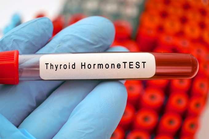 Thyroid Test